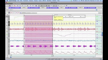 User Interface Features in AcqKnowledge