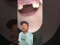 Tu alimentación es muy importante, pero es más importante tener dientes para poder comer