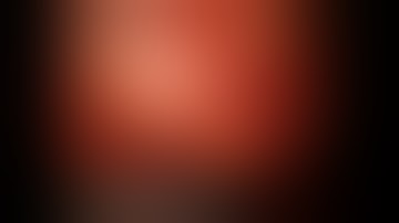 Retroperitoneal Robotic Partial Nephrectomy