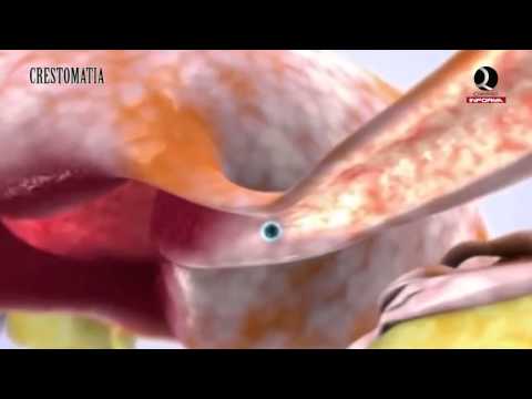 Vídeo: Se Crearon Espermatozoides Y óvulos A Partir De Células De Piel Humana - Vista Alternativa