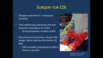 New Paradigms in the Management of C. difficile