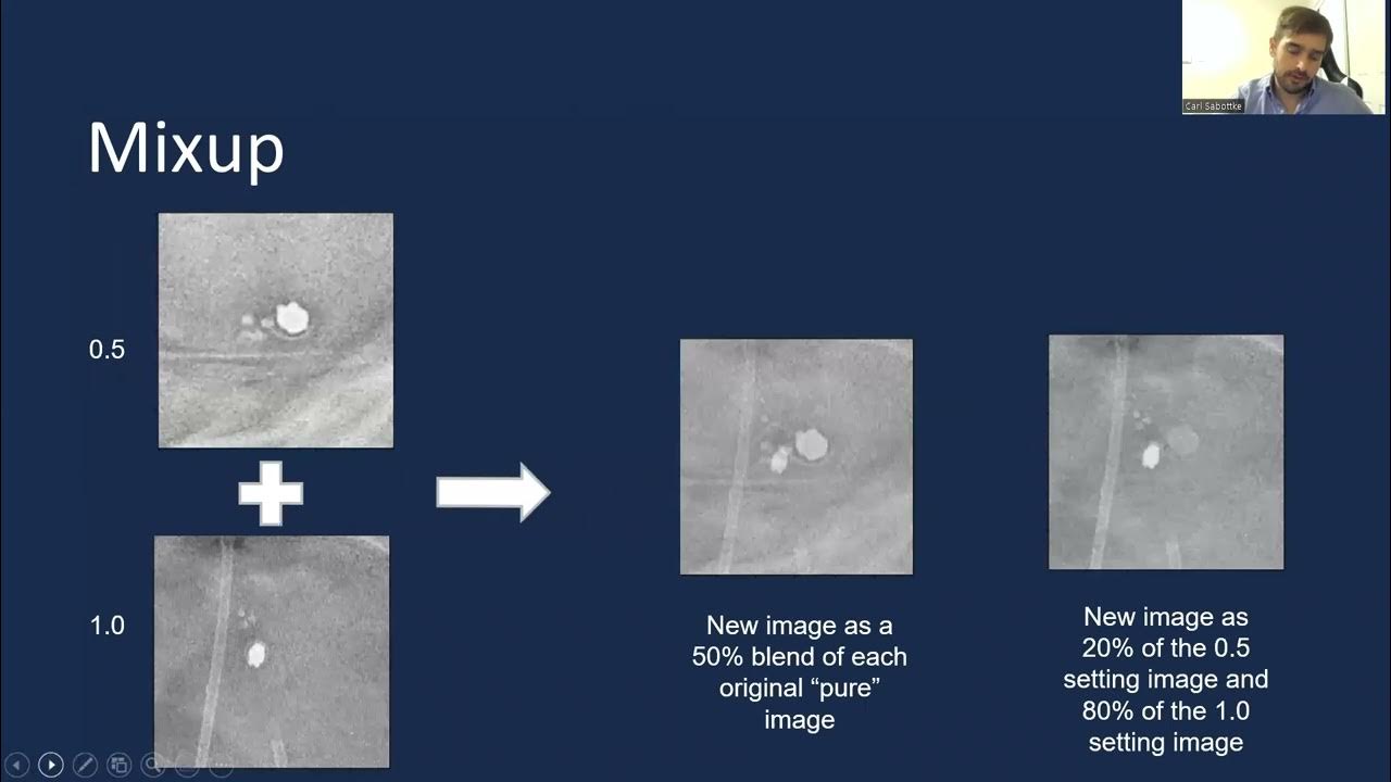 Convolutional Neural Network Identification of Medtronic Strata (VP