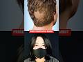 PROSES TRANSPLANTASI RAMBUT‼️#shorts #film #movie #faktamenarik