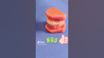 Đồ ăn nào an toàn cho niềng răng ? Hãy Cùng Thử Với Nho Nhé! |Dr Cường Official