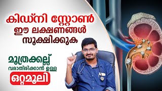 കിഡ്‌നി സ്റ്റോൺ ഈ ലക്ഷണങ്ങൾ സൂക്ഷിക്കുക | Kidney Stone Home Remedy | Dr Basil Yousuf