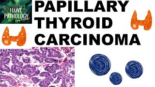 PAPILLARY THYROID CARCINOMA : Gross and Microscopic features