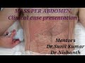 MASS PER ABDOMEN Clinical case presentation