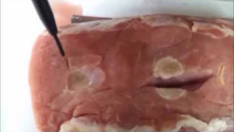 RF-Surgical unit-V4000 Cut & Coag