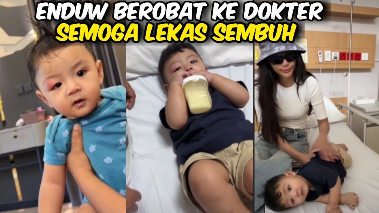 ENDUW DI BAWA KE DOKTER ‼️AKIBAT DI GIGIT NYAMUK DI BAGIAN MATANYA @WARGANETKONOHA-y3c 
