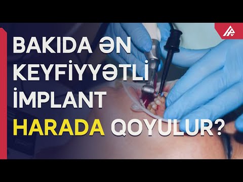 Video: İmplantasiya uğursuz ola bilərmi?