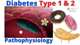 Diabetes Type1 Vs Type 2 - Pathophysiology Of Diabetes - Dm1 Vs Dm2.