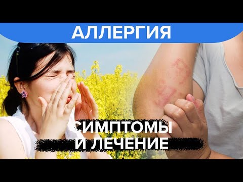 Видео: Симптомы и лечение аллергии на дрожжи