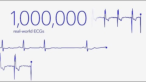 How did AccuRhythm™ AI algorithms learn?