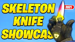 ALL SKELETON KNIFE SKINS SHOWCASE WITH PRICES (2021) - CS:GO