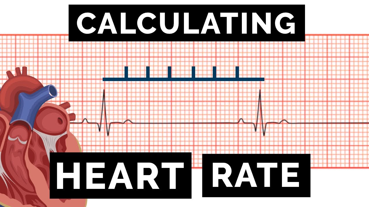 Calculating Heart Rate On An ECG EKG OSCE Guide UKMLA CPSA 
