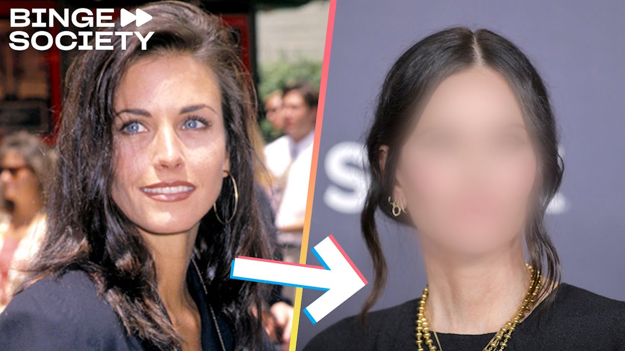 Avant & Après Acteurs et Chirurgie Esthétique YouTube