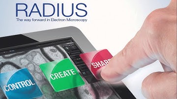 Shading (Flatfield) Correction with RADIUS