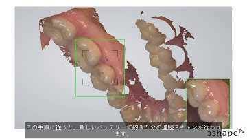 TRIOS 3 Wireless - Daily use JP