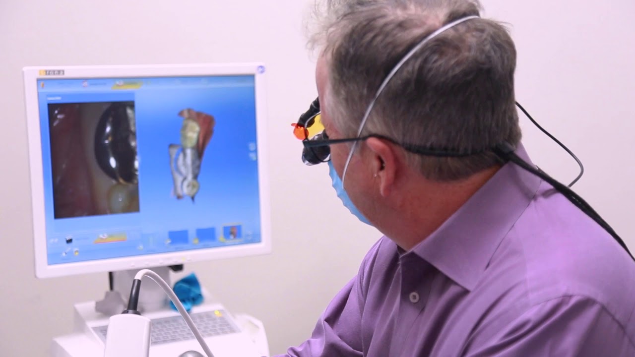 What is a CEREC? Horseshoe Bay Dental YouTube