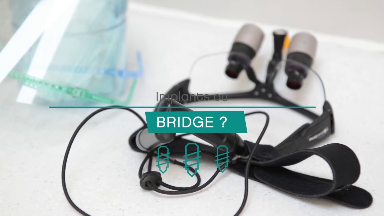 bridge complet sur implant prix