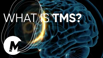 Jak TMS stimuluje mozek?