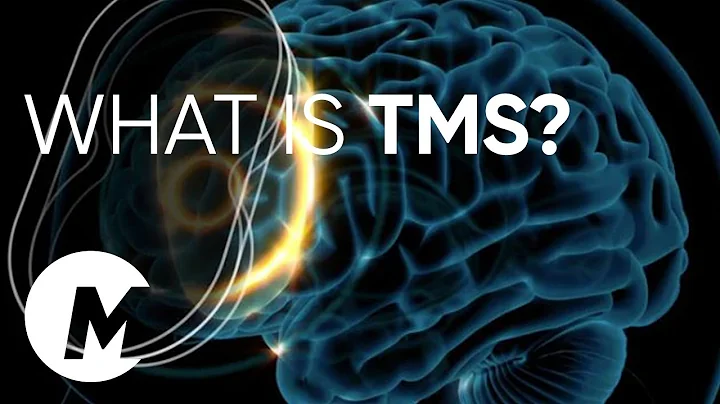 What is TMS? How does TMS work? MagVenture TMS Therapy