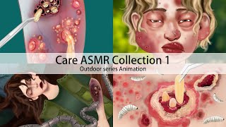 ASMR Treatment Animated Series 1｜Parasites, trypophobia, pustule treatment, skin care｜big collection