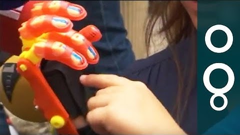 French boy, 6, first to receive 3D-printed prosthetic limb