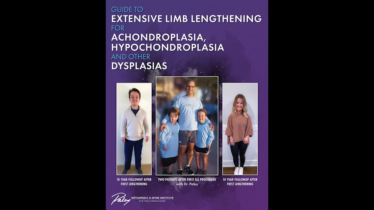 hypochondroplasia symptoms