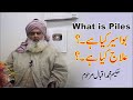 Piles hemorrhoids  bawaseer ka elaj    videio 4  al huda guidance