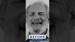 Check out these INCREDIBLE smile transformations 🤩💙 #shorts