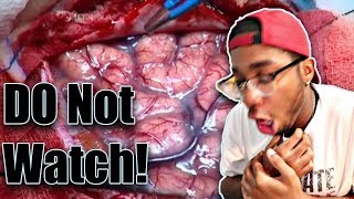 THE NASTIEST VIDEOS EVER | WARNING!!  (PUKE, PUSS, BLOOD and GUTS!!!)