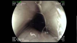 endoscopy llama 2
