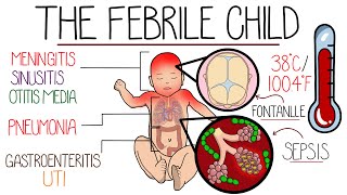 Approach to Fever in Children in 10 Minutes (with Red Flags) by Rhesus Medicine 16,064 views 10 months ago 10 minutes, 30 seconds