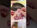 Ear Cleaning Asmr Satisfying Removel #shorts