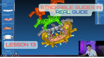 Surgical guides in RealGuide Tutorial. Lesson 13. Stackable guides,  All on 4. Part 3