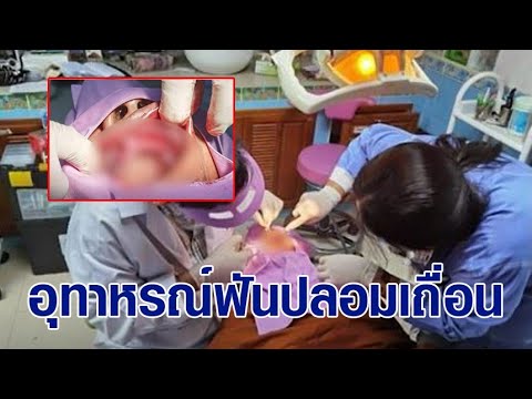 วีดีโอ: วัตถุประสงค์ทั่วไปสำหรับการใช้ตำแหน่ง decubitus ด้านข้างคืออะไร?