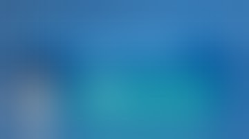 Orbital Decompression STEP by STEP