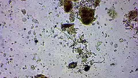 Soil under microscope