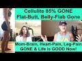 Amazing Cellulite Success Story Plus Major Health Improvements Beyond Cellulite from Stephanie G