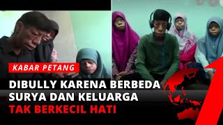 Alami Kelainan Genetik, Surya: Bully-an Netizen Kami Jadikan Motivasi | Kabar Petang tvOne