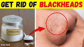 How to Get rid of Blackheads on Chin and Nose at Home by Eva Fox 2,766 views 2 years ago 3 minutes, 12 seconds