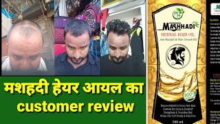 Mashhadi  herbal hair oil customer review before and after result by Hakeem S A Rahman9557217026