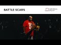 Battle Scars  | Relentless Church