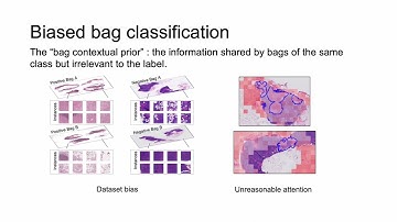 [CVPR 2023 Highlight] Interventional Bag Multi-Instance Learning On Whole-Slide Pathological Images
