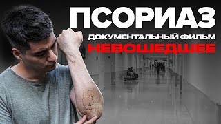 видео: Псориаз | Невошедшее картинка: Псориаз | Невошедшее