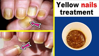 If you suffer from yellowing nails, this recipe is for you, you will get bright white nails