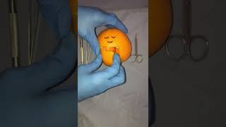 That Time I Delivered Twin Oranges 🥰 #Birth #Fruit #Surgery #Twins