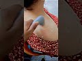 shoulder pain 😱😱 #shortsvideo #viralshort #shoulderpain #pain #health #frozen #exercise #dr #drgulam