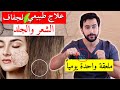 العلاج الطبيعي الأقوى والأساسي لجفاف الجلد والشعر | ملعقة واحدة فقط!